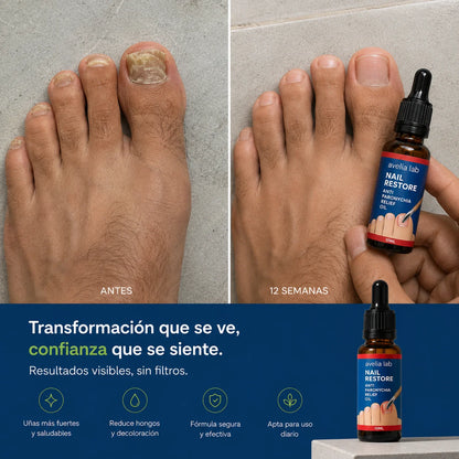 Nail Restore™ | Elimina los hongos en 7 días