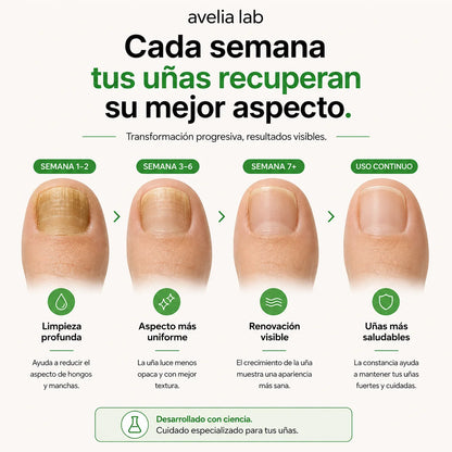 Nail Restore™ | Elimina los hongos en 7 días