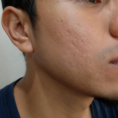 Jorge P.
