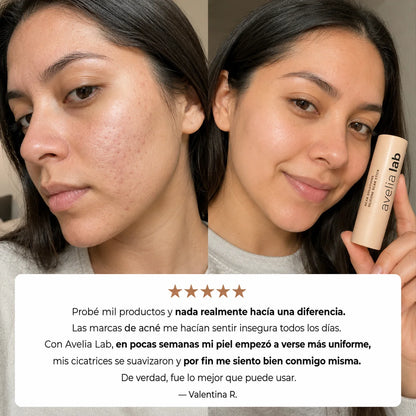 Skin Restore™