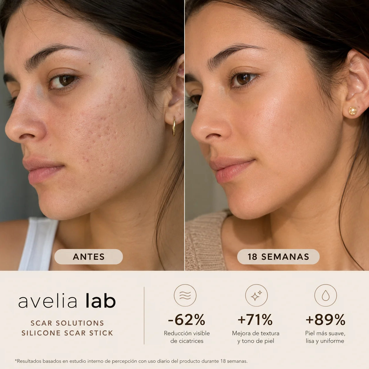 Skin Restore™